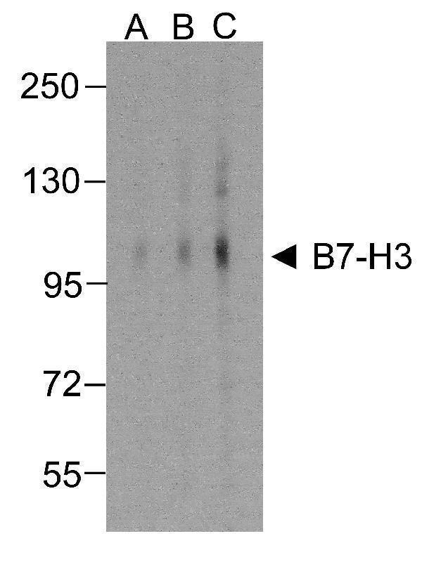 Western blot analysis of B7-H3 in HEK293 cells using B7-H3 antibody at (A) 0