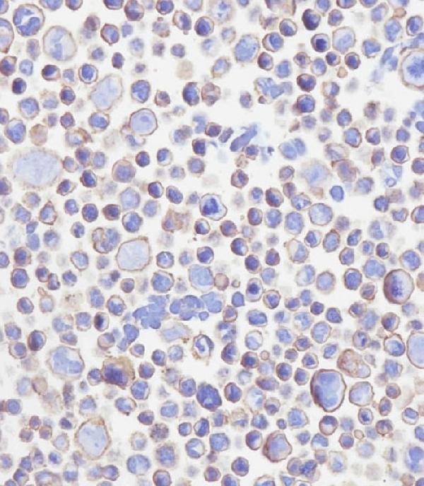 m02220 3 anti cd276 antibody ihc p testing 3