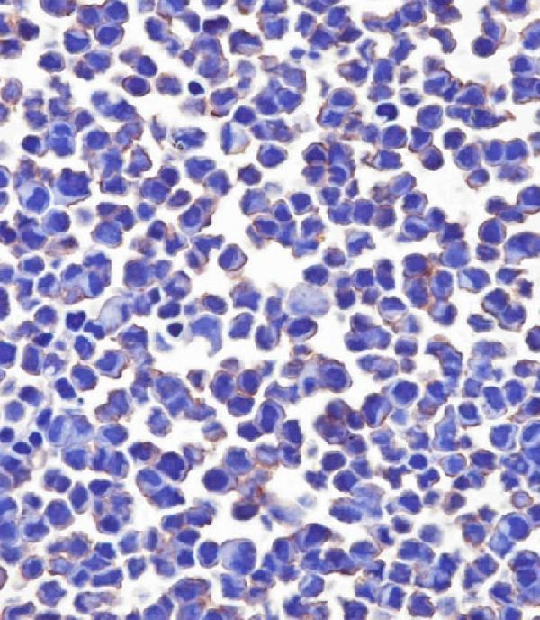 m02220 3 anti cd276 antibody ihc p testing 4