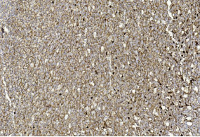 m02220 3 anti cd276 antibody ihc testing 2