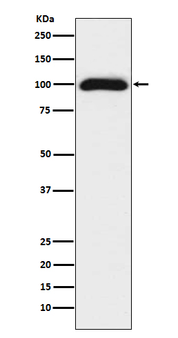 Western blot analysis of CD276 expression in 293T cell lysate