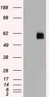 HEK293T cells were transfected with the pCMV6-ENTRY control (Left lane) or pCMV6-ENTRY STK3 (Right lane) cDNA for 48 hrs and lysed