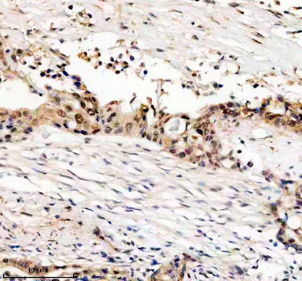 IHC analysis of STK3 using anti-STK3 antibody (M02224-1)