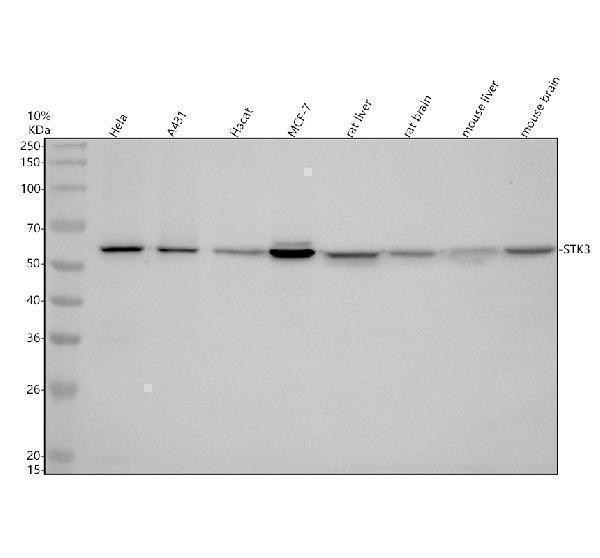 Western blot analysis of STK3 using anti-STK3 antibody (M02224)