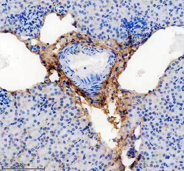 IHC analysis of Collagen Type VI/COL6A1 using anti-Collagen Type VI/COL6A1 antibody (M02226)