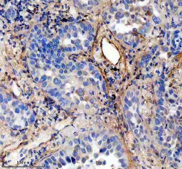 m02226 col6a1 primary antibodies ihc testing 10
