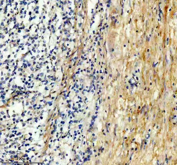m02226 col6a1 primary antibodies ihc testing 11