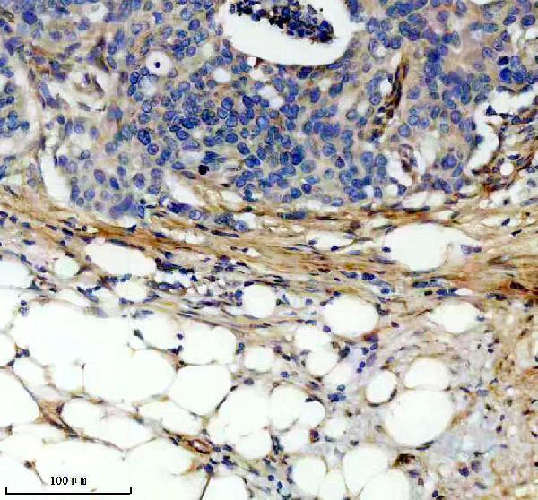 m02226 col6a1 primary antibodies ihc testing 12