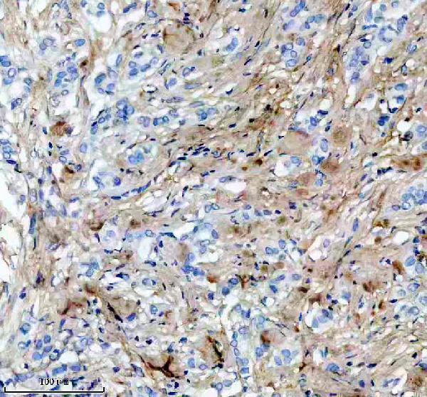 m02226 col6a1 primary antibodies ihc testing 13