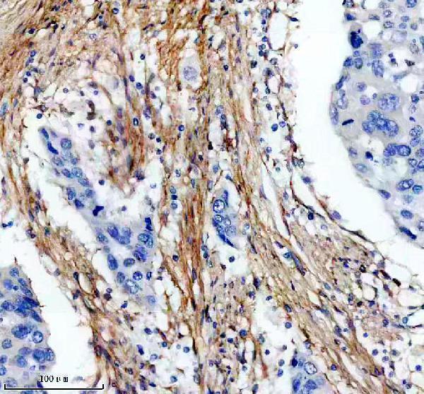 m02226 col6a1 primary antibodies ihc testing 14