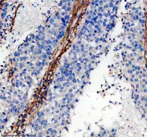 m02226 col6a1 primary antibodies ihc testing 15