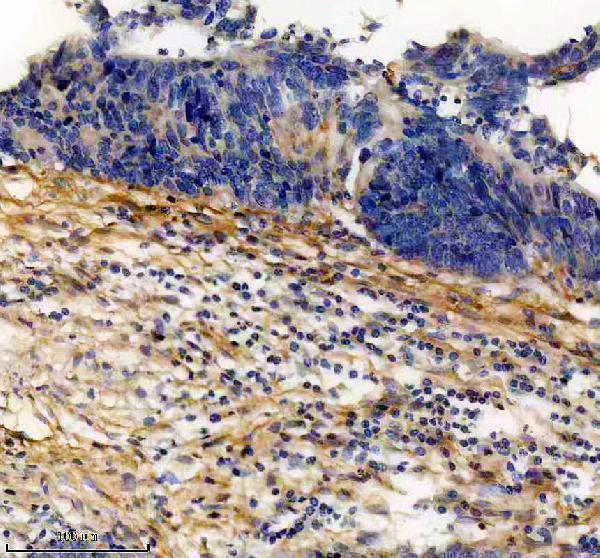m02226 col6a1 primary antibodies ihc testing 16