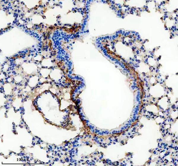 m02226 col6a1 primary antibodies ihc testing 2
