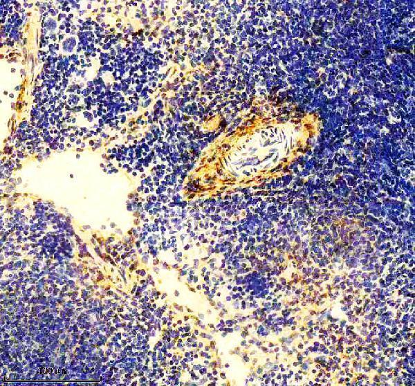 m02226 col6a1 primary antibodies ihc testing 3