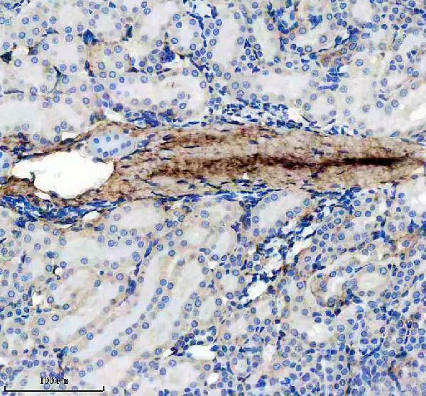 m02226 col6a1 primary antibodies ihc testing 5