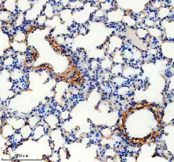 m02226 col6a1 primary antibodies ihc testing 6