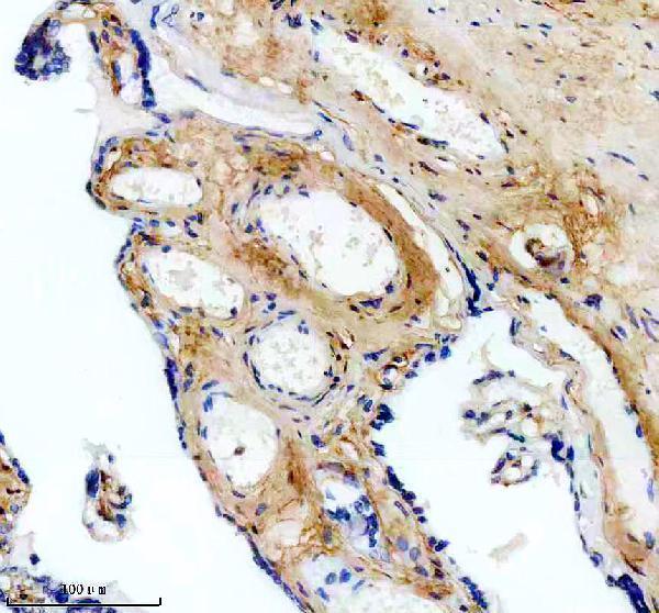 m02226 col6a1 primary antibodies ihc testing 9