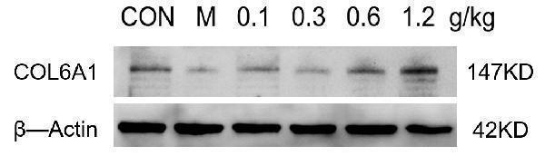 Western blot analysis of COL6A1 using anti-COL6A1 antibody (M02226)