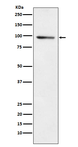 Western blot analysis of PDE4B expression in A549 cell lysate