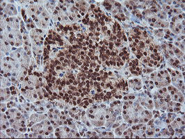 m02228 anti pde4 pde4b mouse monoclonal antibody clone id oti1d12 ihc testing 5