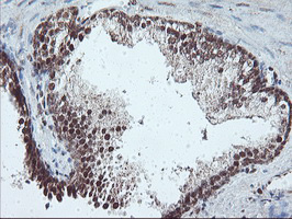 m02228 anti pde4 pde4b mouse monoclonal antibody clone id oti1d12 ihc testing 7