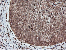 m02228 anti pde4 pde4b mouse monoclonal antibody clone id oti1d12 ihc testing 9