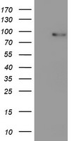 HEK293T cells were transfected with the pCMV6-ENTRY control (Left lane) or pCMV6-ENTRY PDE4B (Right lane) cDNA for 48 hrs and lysed