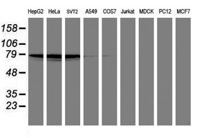 Western blot analysis of extracts (35ug) from 9 different cell lines by using anti-PDE4B monoclonal antibody (HepG2: human; HeLa: human; SVT2: mouse; A549: human; COS7: monkey; Jurkat: human; MDCK: canine; PC12: rat; MCF7: human)