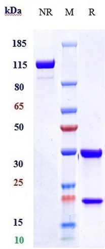 Anti-TGM2/Transglutaminase 2 Reference Antibody (zampilimab) on SDS-PAGE under reducing (R) condition