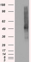 HEK293T cells were transfected with the pCMV6-ENTRY control (Left lane) or pCMV6-ENTRY SLC18A2 (Right lane) cDNA for 48 hrs and lysed