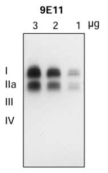 Figure from citation: Western Blot of SLC18A2 protein level by using anti-SLC18A2 (9E11) antibody in the striatum of autopsied human brain
