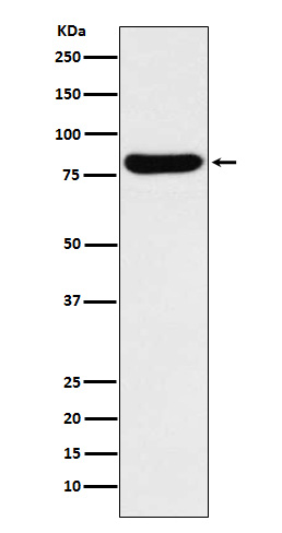 Western blot analysis of GUSB expression in K562 cell lysate