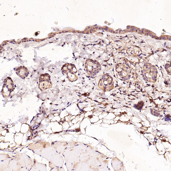 m02236 1 ihc10