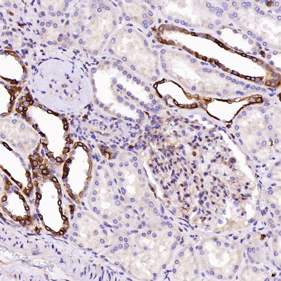 m02236 1 ihc9