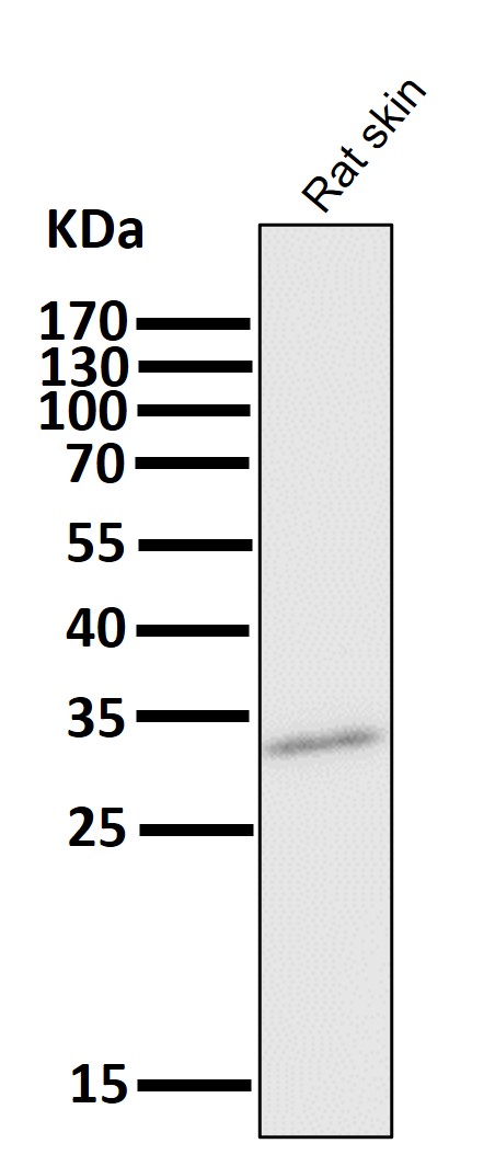 All lanes use the Antibody at 1:5K dilution for 1 hour at room temperature