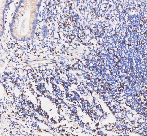  IHC analysis of CD8A using anti-CD8A antibody (M02236-2)
