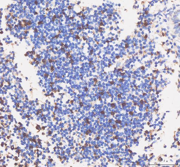 m02236 2 cd8a primary antibodies ihc testing 2