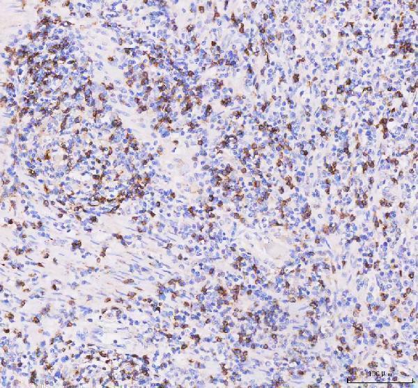 m02236 2 cd8a primary antibodies ihc testing 3