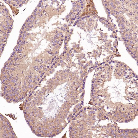 Immunohistochemical analysis of paraffin-embedded Mouse testis, using the Antibody at 1:100 dilution