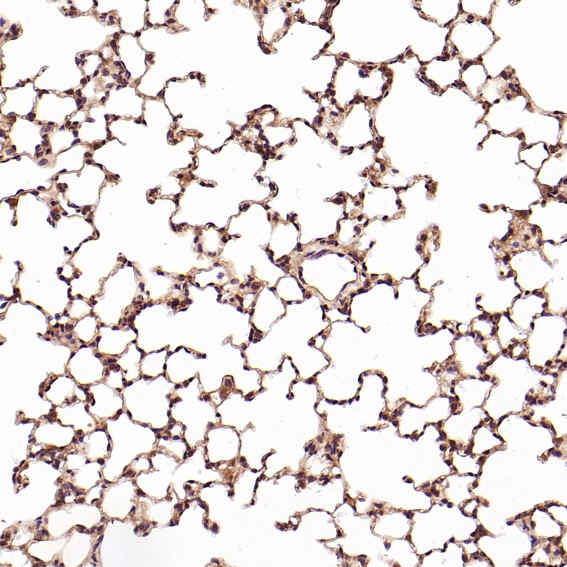 Immunohistochemical analysis of paraffin-embedded Rat liver, using the Antibody at 1:100 dilution