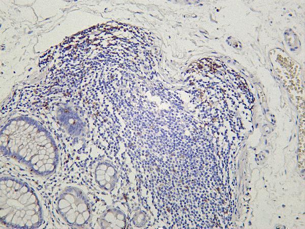 m02236 5 cd8a primary antibodies ihc testing 1