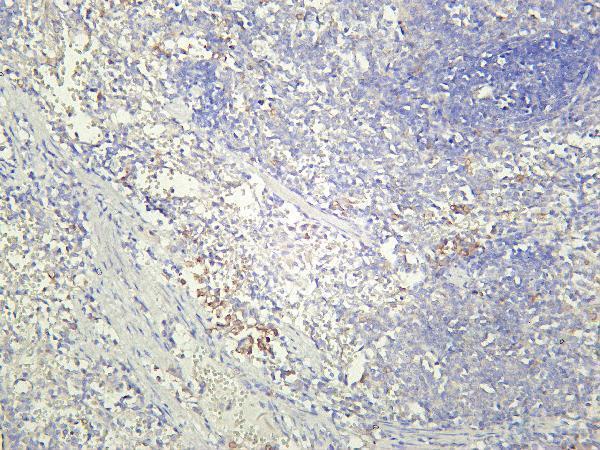m02236 5 cd8a primary antibodies ihc testing 2