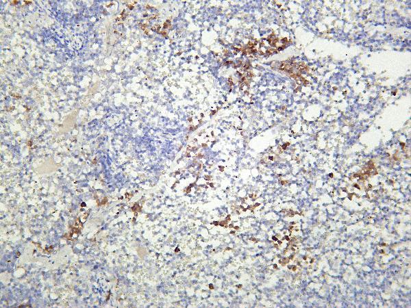 m02236 5 cd8a primary antibodies ihc testing 3