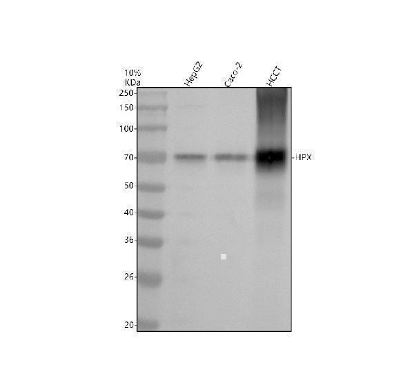 Western blot analysis of Hemopexin/HPX using anti-Hemopexin/HPX antibody (M02237)