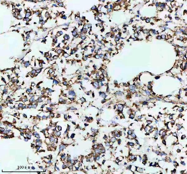 m02240 mct1 primary antibodies ihc testing 2