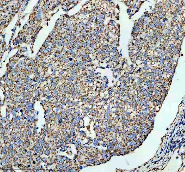 m02240 mct1 primary antibodies ihc testing 3