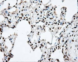 m02241 anti dap kinase 2 dapk2 mouse monoclonal antibody clone id oti1c5 ihc testing 10