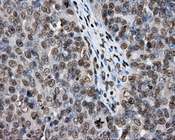 m02241 anti dap kinase 2 dapk2 mouse monoclonal antibody clone id oti1c5 ihc testing 3