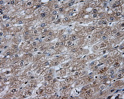 m02241 anti dap kinase 2 dapk2 mouse monoclonal antibody clone id oti1c5 ihc testing 9