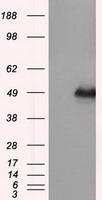 m02241 anti dap kinase 2 dapk2 mouse monoclonal antibody clone id oti1c5 wb testing 1
